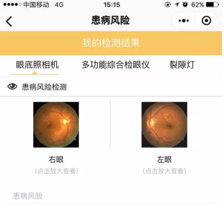星創視界聯手春雨醫生，眼鏡店或成在線問診大入口