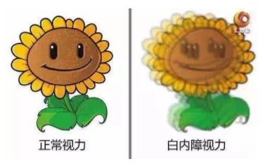 央視《健康之路》：你知道嗎？老花眼視力變好，有可能是患了白內障