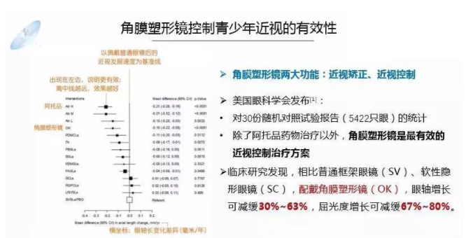 【眼視光前沿】一種具有非球面基弧設計的角膜塑形鏡