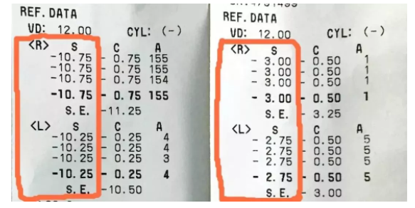 視力康復(fù)騙局：你的視力是如何“被提高”的？
